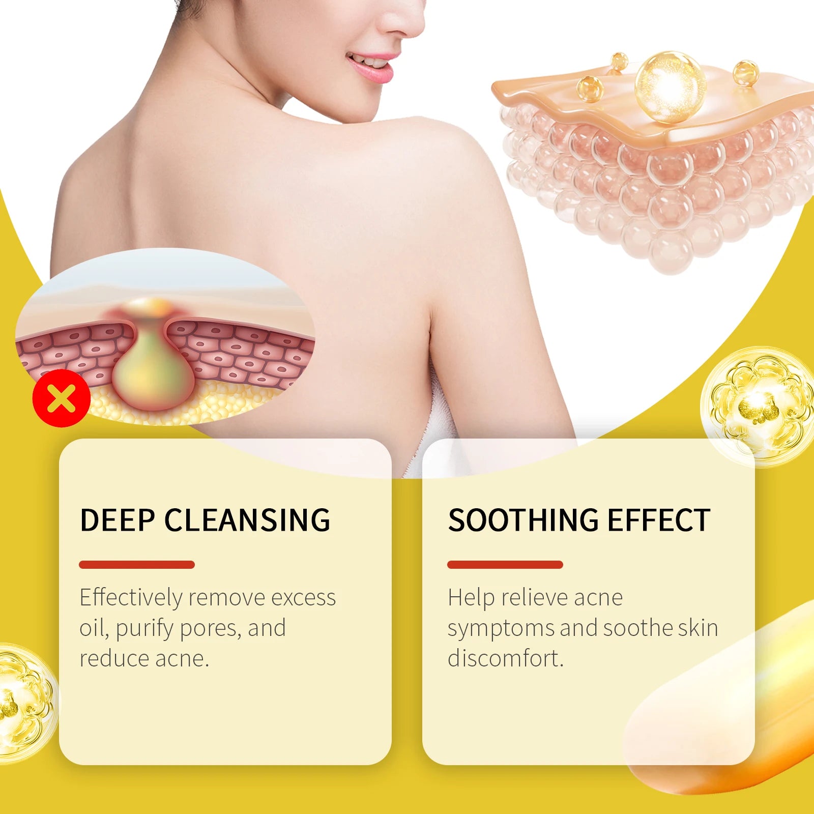 Acne Treatment Soap Pimple Remove Pigment Deep Cleansing Pores Shrink Oil Control Moisturize Body Face Lightening Skin Care Soap